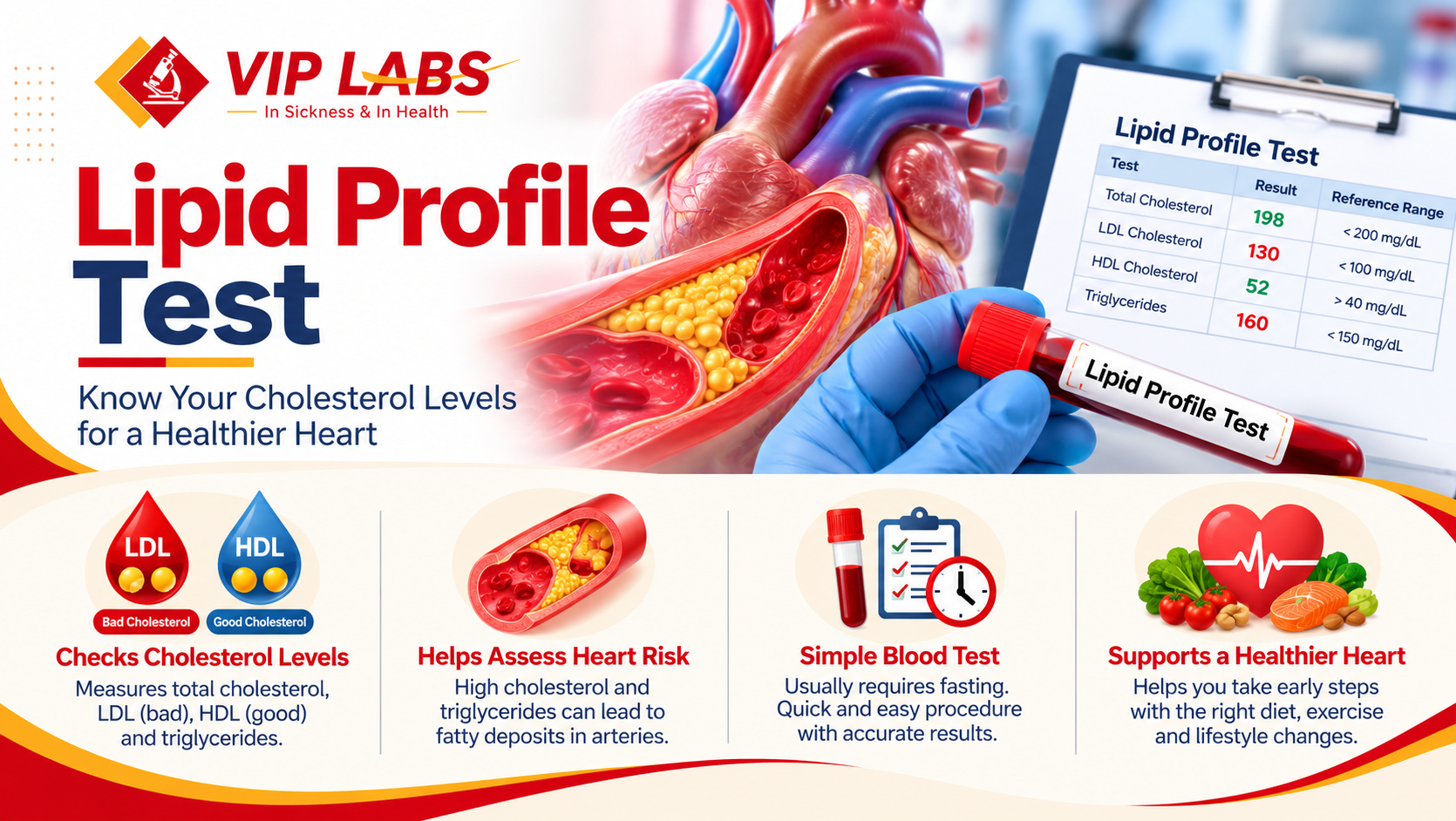 Lipid Profile Test: Complete Information About Cholesterol, Triglycerides and Heart Health